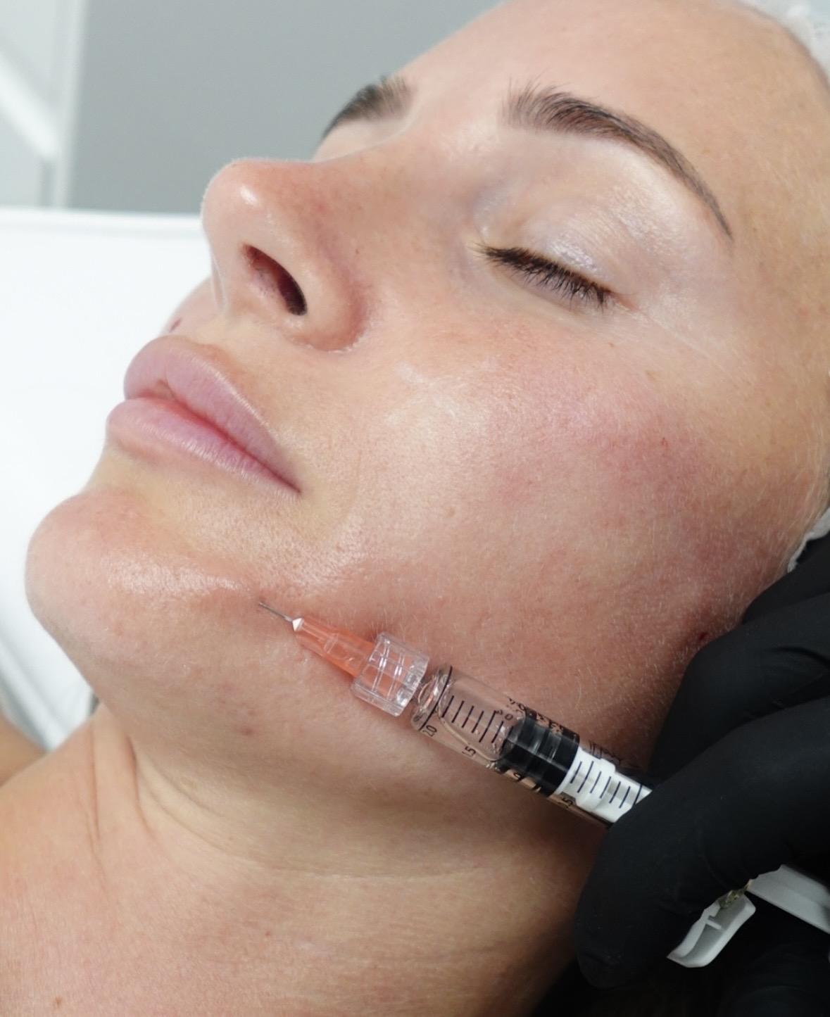 Skin Treatment